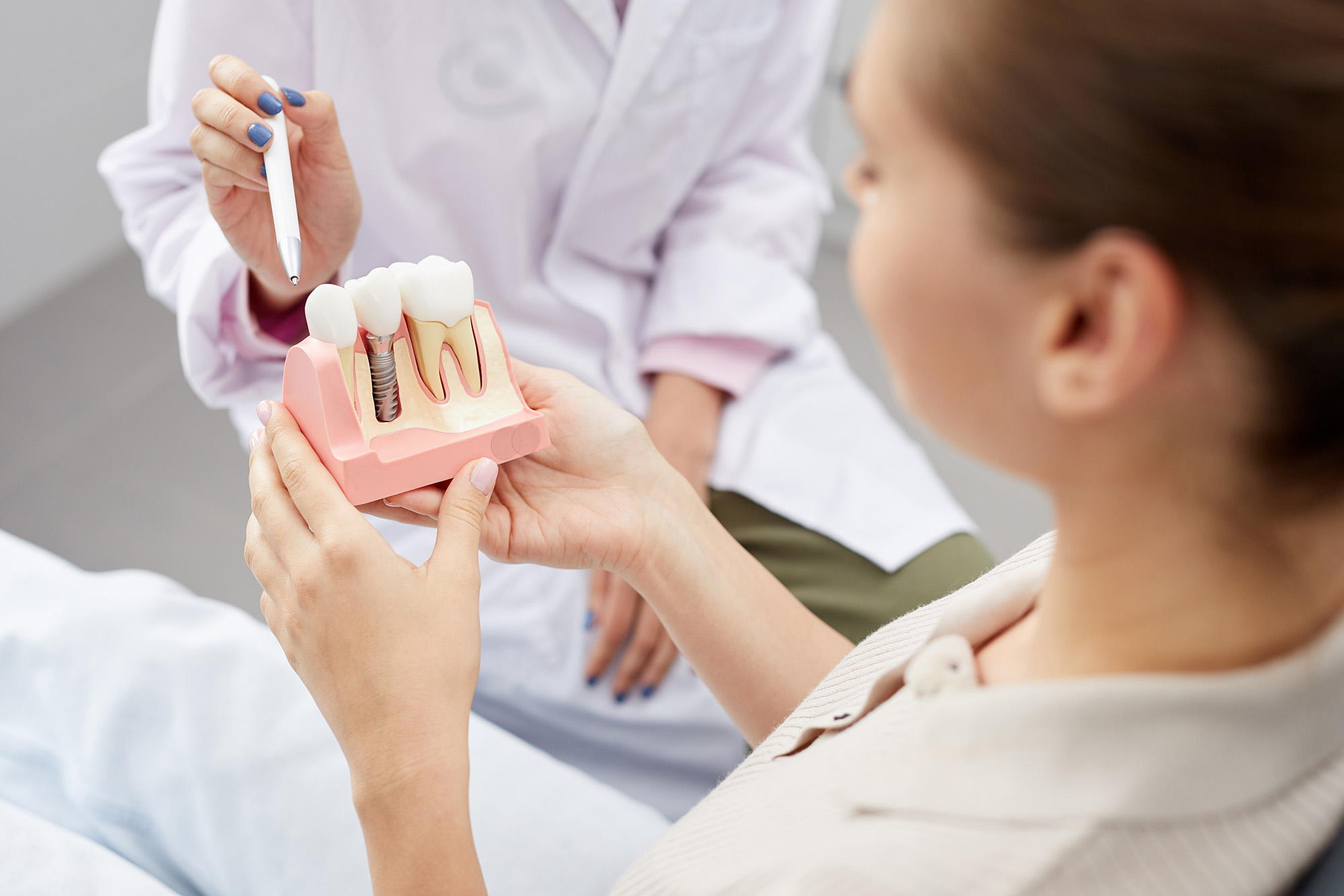 Dentist pointing at dental implant consulting patient at Rosemary Heights Dental in Surrey, BC