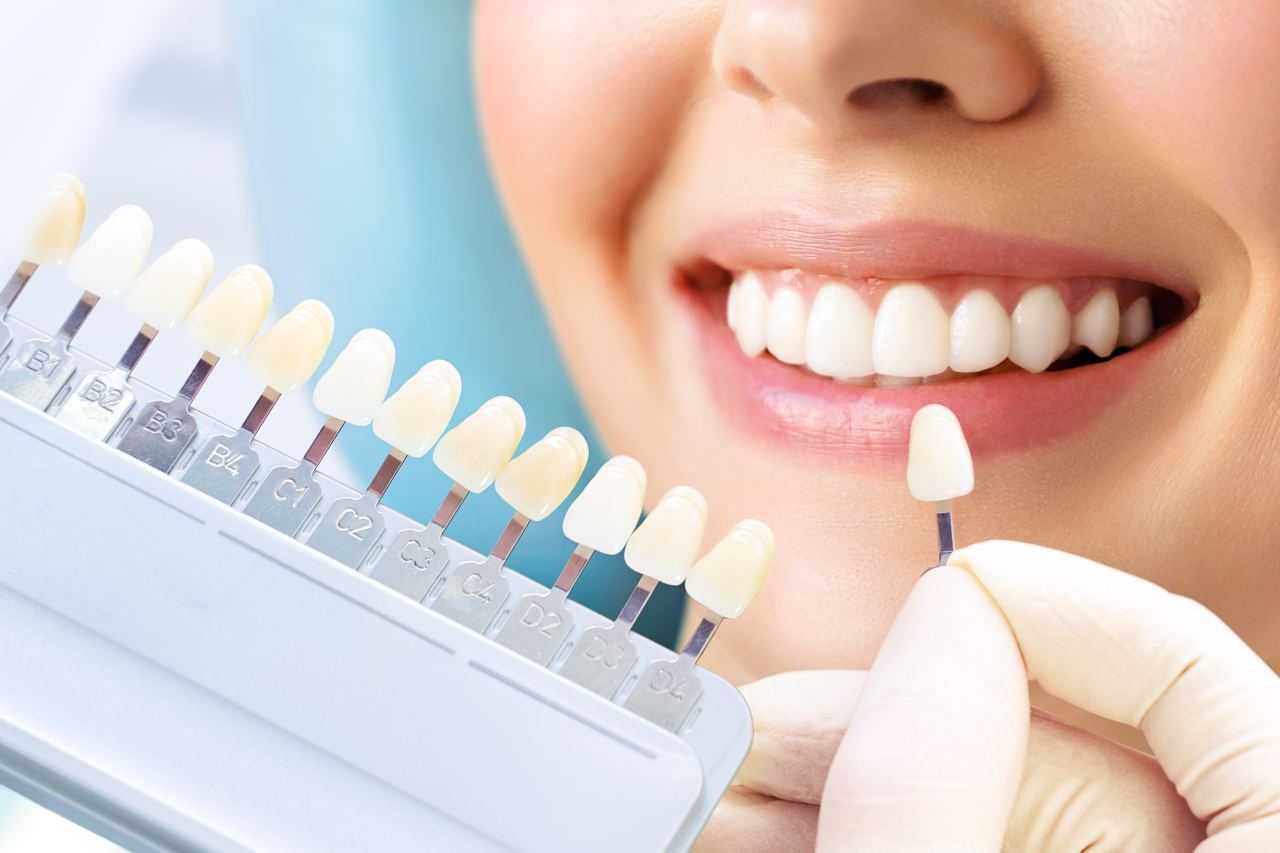 A dentist matching veneers to a patient's teeth for dental veneers in Surrey, BC