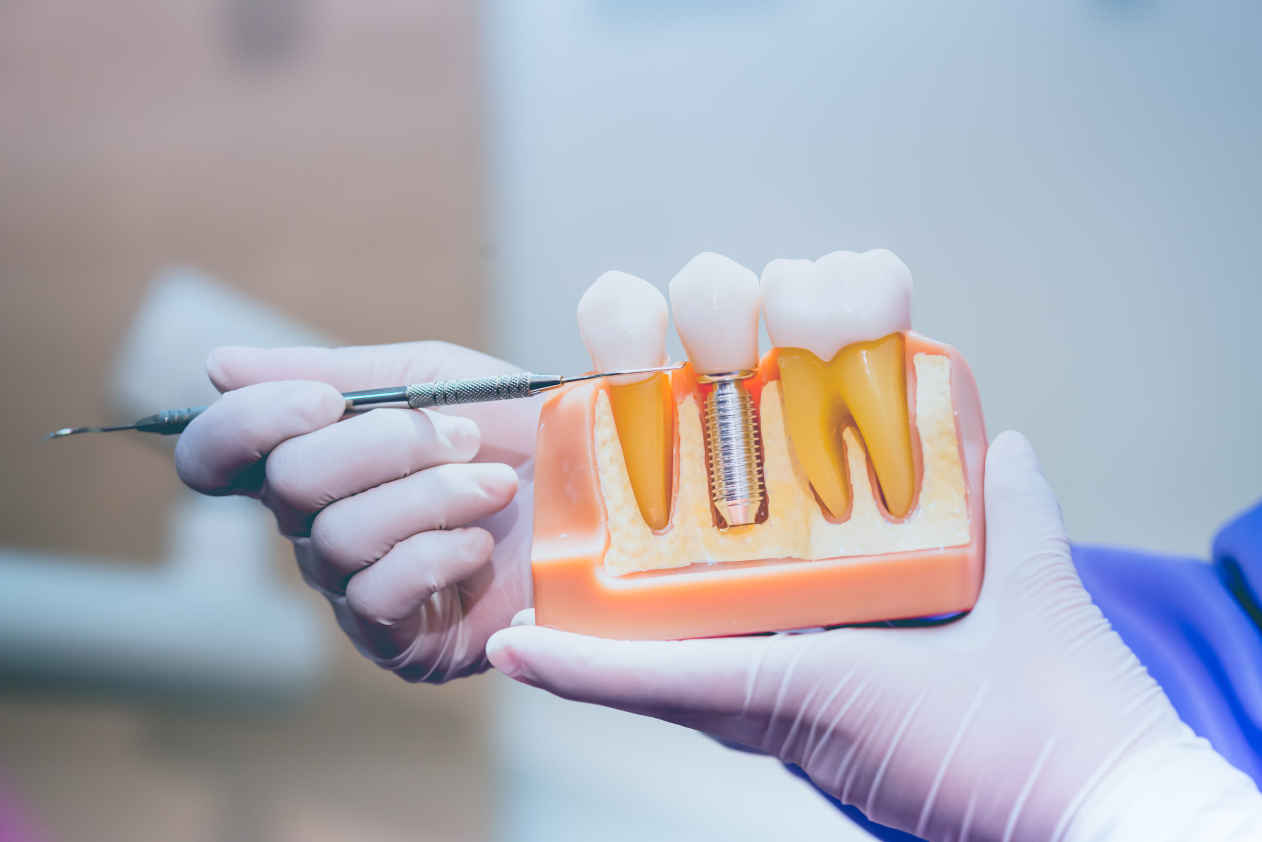 Dentist with single dental implant